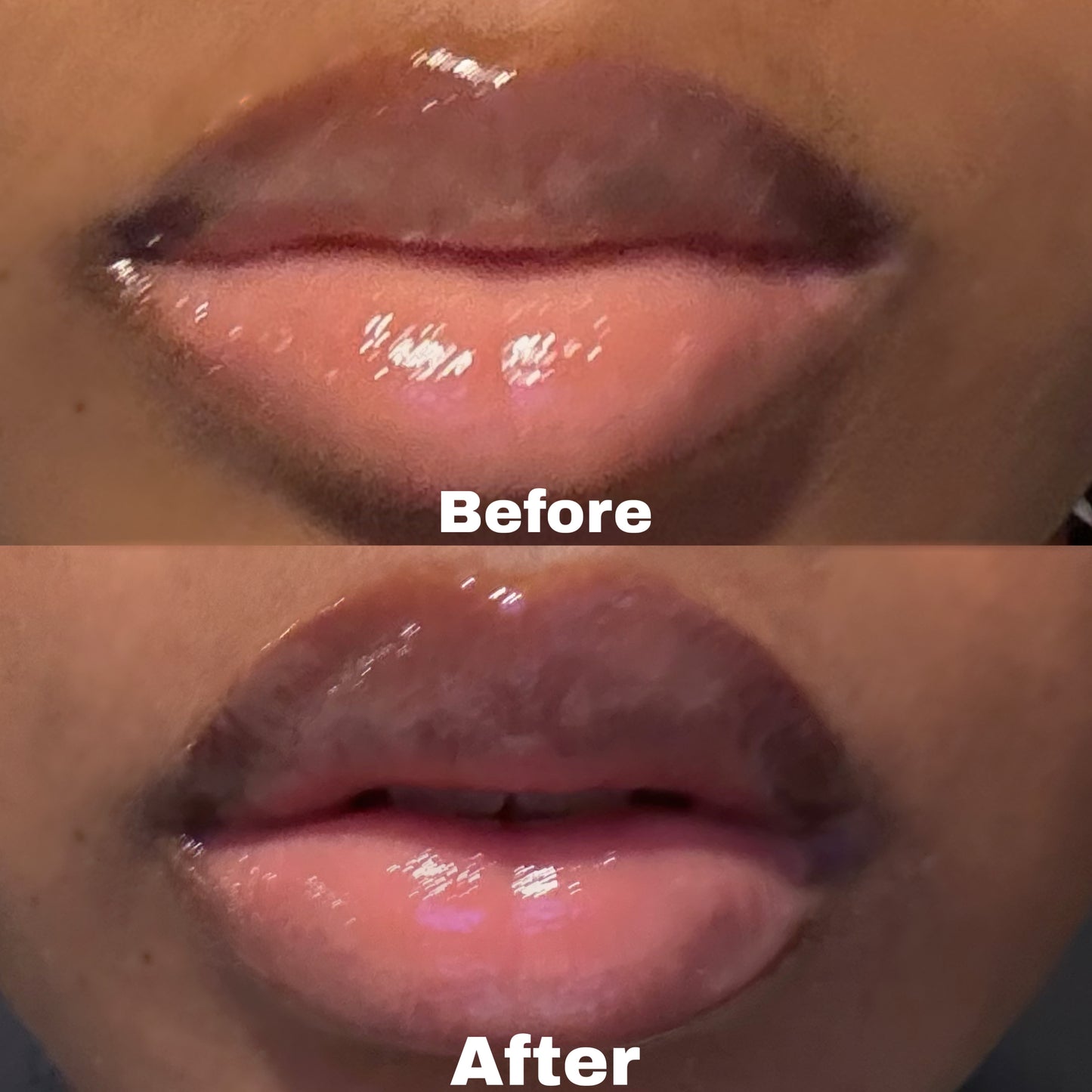 Lip Plumper